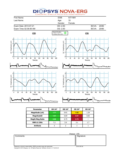 Nova ERG Report