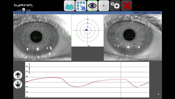 Eye Kinetix Result